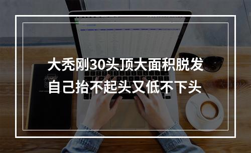 大秃刚30头顶大面积脱发自己抬不起头又低不下头