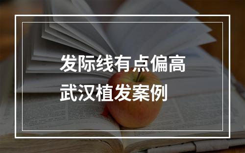 发际线有点偏高武汉植发案例