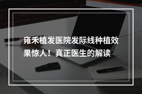 雍禾植发医院发际线种植效果惊人！真正医生的解读