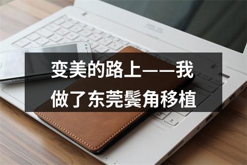 变美的路上——我做了东莞鬓角移植