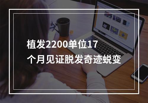 植发2200单位17个月见证脱发奇迹蜕变