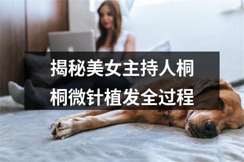 揭秘美女主持人桐桐微针植发全过程