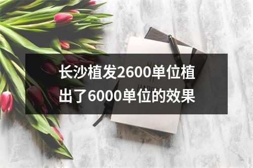 长沙植发2600单位植出了6000单位的效果