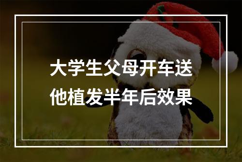 大学生父母开车送他植发半年后效果