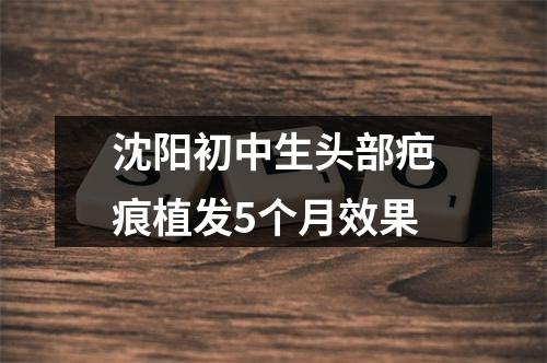 沈阳初中生头部疤痕植发5个月效果