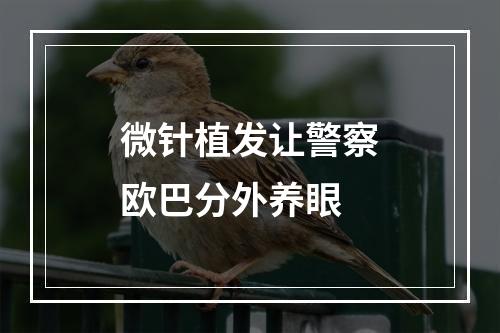 微针植发让警察欧巴分外养眼