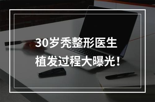 30岁秃整形医生植发过程大曝光！