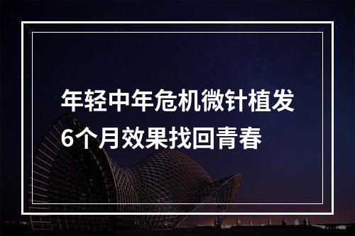 年轻中年危机微针植发6个月效果找回青春