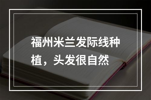 福州米兰发际线种植，头发很自然