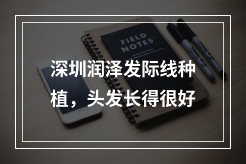 深圳润泽发际线种植，头发长得很好