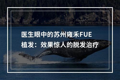 医生眼中的苏州雍禾FUE植发：效果惊人的脱发治疗