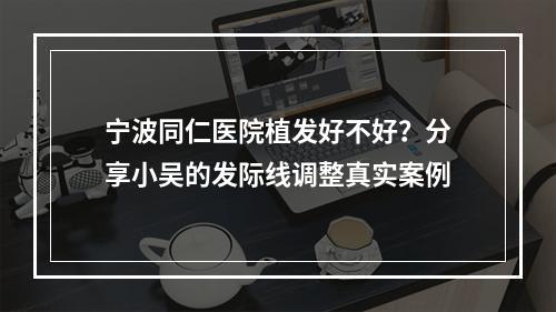 宁波同仁医院植发好不好？分享小吴的发际线调整真实案例