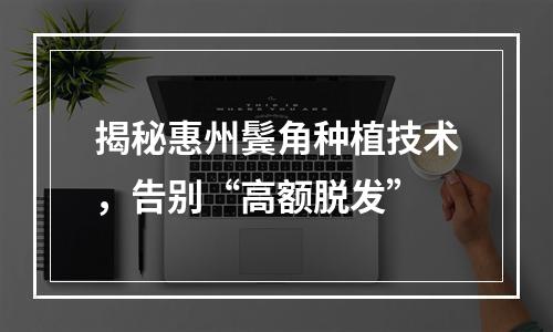 揭秘惠州鬓角种植技术，告别“高额脱发”