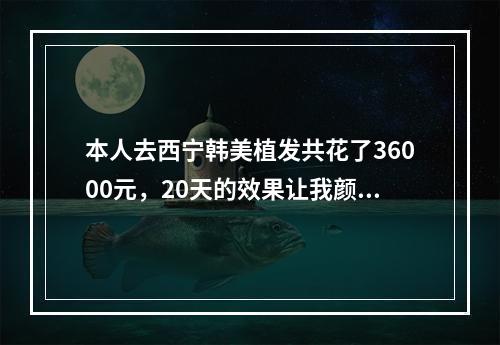 本人去西宁韩美植发共花了36000元，20天的效果让我颜值飙升