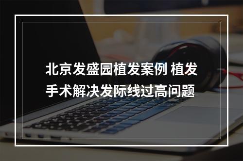 北京发盛园植发案例 植发手术解决发际线过高问题