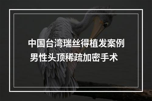 中国台湾瑞丝得植发案例 男性头顶稀疏加密手术