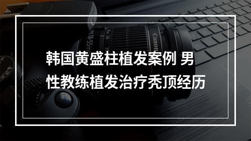 韩国黄盛柱植发案例 男性教练植发治疗秃顶经历