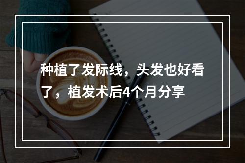 种植了发际线，头发也好看了，植发术后4个月分享