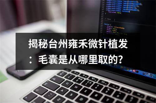 揭秘台州雍禾微针植发：毛囊是从哪里取的？