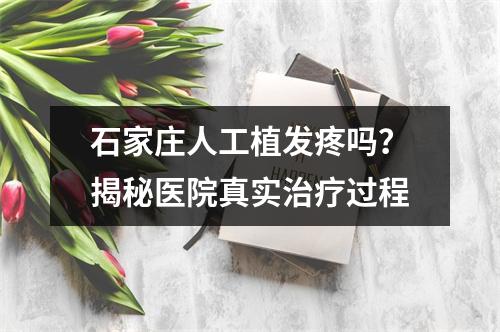 石家庄人工植发疼吗？揭秘医院真实治疗过程