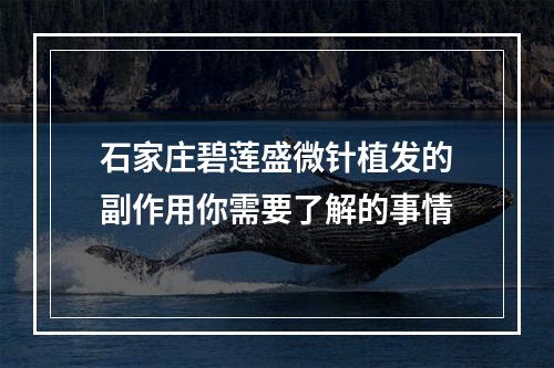 石家庄碧莲盛微针植发的副作用你需要了解的事情