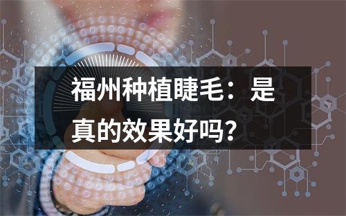 福州种植睫毛：是真的效果好吗？