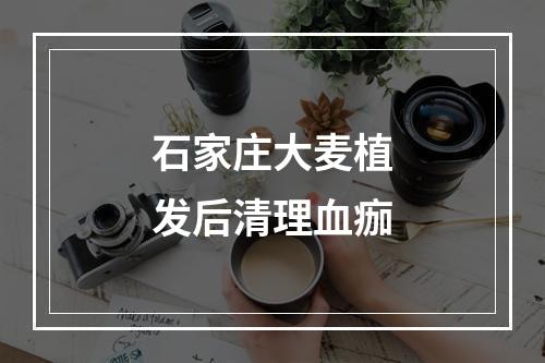 石家庄大麦植发后清理血痂