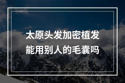 太原头发加密植发能用别人的毛囊吗