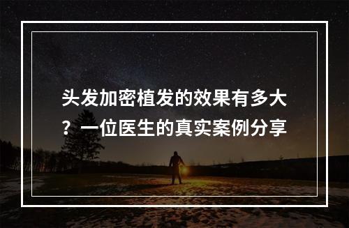 头发加密植发的效果有多大？一位医生的真实案例分享