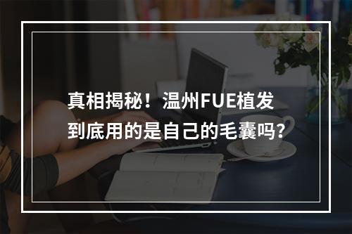 真相揭秘！温州FUE植发到底用的是自己的毛囊吗？