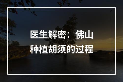 医生解密：佛山种植胡须的过程