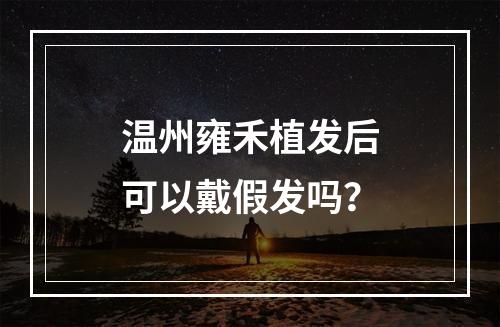 温州雍禾植发后可以戴假发吗？