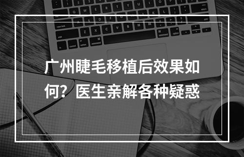 广州睫毛移植后效果如何？医生亲解各种疑惑