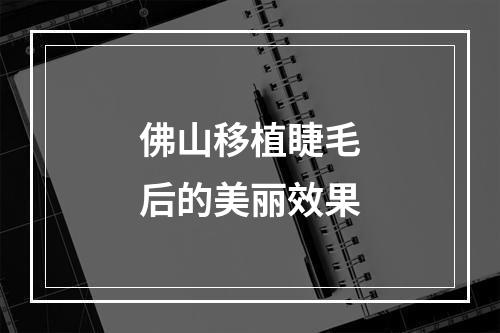 佛山移植睫毛后的美丽效果