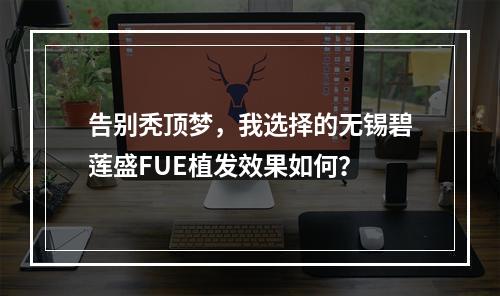 告别秃顶梦，我选择的无锡碧莲盛FUE植发效果如何？