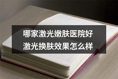 哪家激光嫩肤医院好 激光换肤效果怎么样