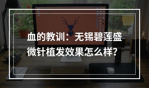 血的教训：无锡碧莲盛微针植发效果怎么样？