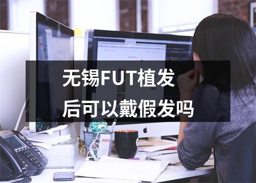 无锡FUT植发后可以戴假发吗