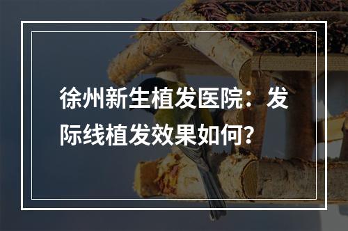 徐州新生植发医院：发际线植发效果如何？