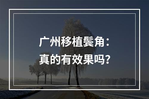 广州移植鬓角：真的有效果吗？