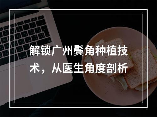 解锁广州鬓角种植技术，从医生角度剖析