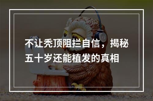 不让秃顶阻拦自信，揭秘五十岁还能植发的真相