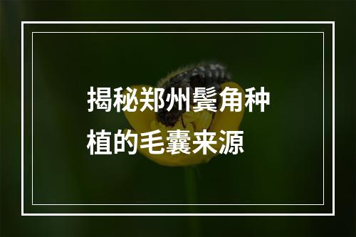 揭秘郑州鬓角种植的毛囊来源