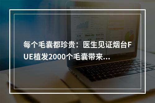 每个毛囊都珍贵：医生见证烟台FUE植发2000个毛囊带来的变化