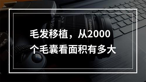 毛发移植，从2000个毛囊看面积有多大