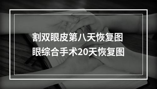 割双眼皮第八天恢复图 眼综合手术20天恢复图