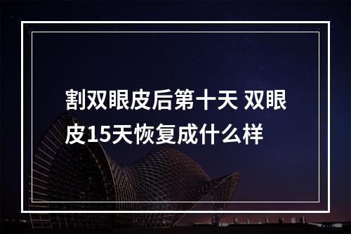 割双眼皮后第十天 双眼皮15天恢复成什么样