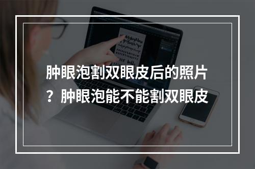 肿眼泡割双眼皮后的照片？肿眼泡能不能割双眼皮