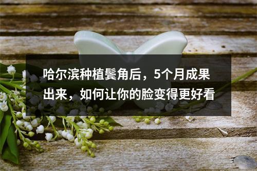 哈尔滨种植鬓角后，5个月成果出来，如何让你的脸变得更好看