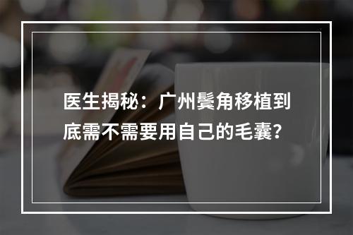 医生揭秘：广州鬓角移植到底需不需要用自己的毛囊？